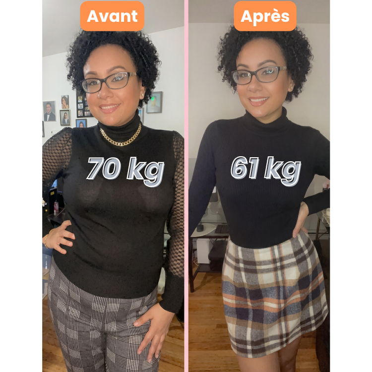 Avant / Après Camille, 29 ans