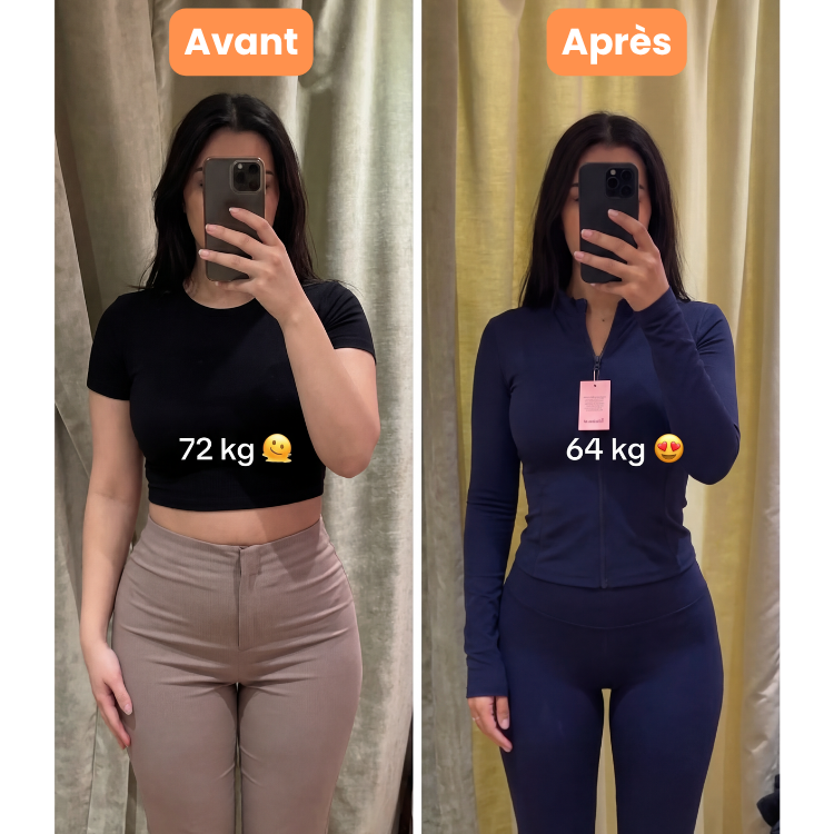 Avant / Après Léa, 26 ans